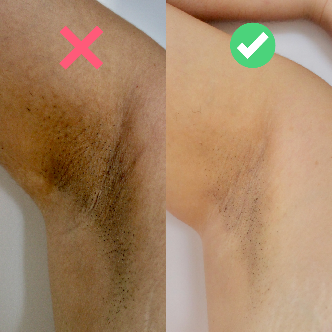 Rutina Aclarante crema y exfoliante