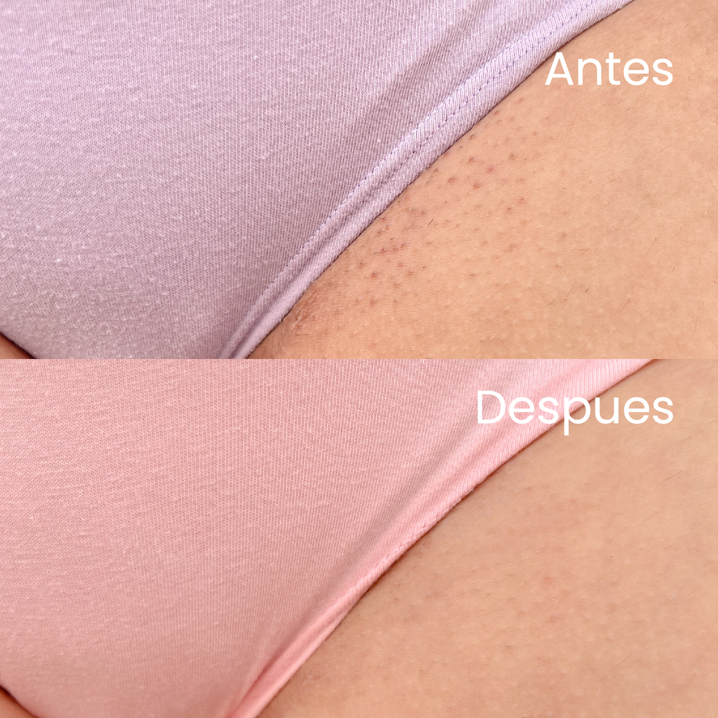 Gel para Depilación Zona V